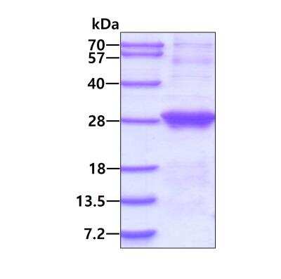 SDS-PAGE: Recombinant Human Dynactin 6 His Protein [NBP2-51843]