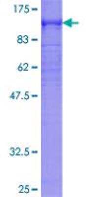 SDS-PAGE: Recombinant Human Dystrophin GST (N-Term) Protein [H00001756-P01]