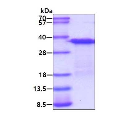 SDS-PAGE: Recombinant Human EBAG9/RCAS1 His Protein [NBC1-18521]
