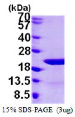 SDS-PAGE: Recombinant Human EIF1AY His Protein [NBP1-50981]