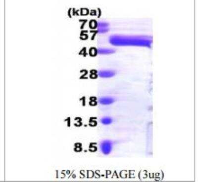 SDS-PAGE: Recombinant Human ERK1 His Protein [NBP1-48333]