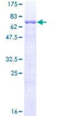 SDS-PAGE: Recombinant Human ERR alpha/NR3B1 GST (N-Term) Protein [H00002101-P01]