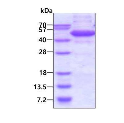 SDS-PAGE: Recombinant Human ETS1 associated protein II His Protein [NBP2-22913]