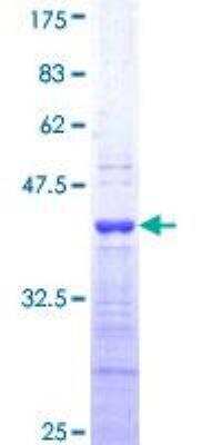 SDS-PAGE: Recombinant Human Endothelin-1 GST (N-Term) Protein [H00001906-Q01]
