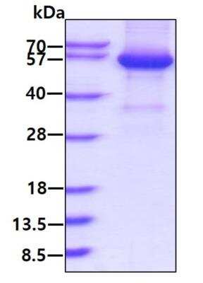SDS-PAGE: Recombinant Human Ephrin-A3 hIgG-His Protein [NBP2-77495]