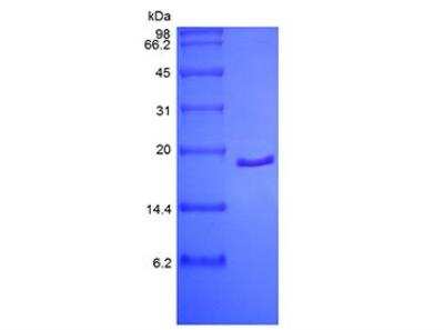 SDS-PAGE: Recombinant Human FGF acidic/FGF1 Protein [NBP2-61310]