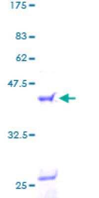 SDS-PAGE: Recombinant Human FLAP GST (N-Term) Protein [H00000241-P01]