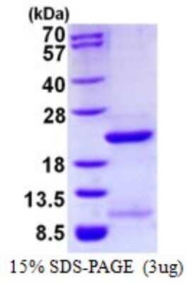 SDS-PAGE: Recombinant Human FUBP1 His Protein [NBP1-98942]