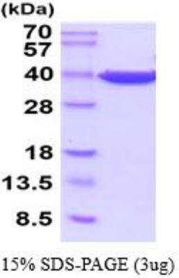 SDS-PAGE: Recombinant Human GAPDH Protein [NBP2-52615]