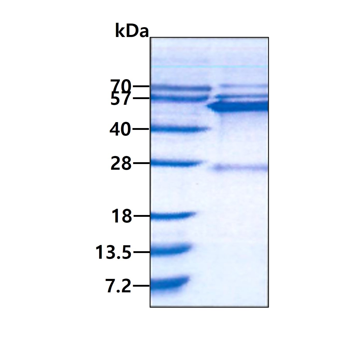 SDS-PAGE: Recombinant Human GATM His Protein [NBP1-99081]