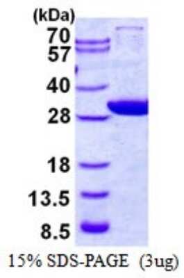 SDS-PAGE: Recombinant Human GCLM His Protein [NBP1-98869]