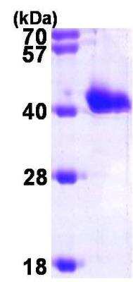 SDS-PAGE: Recombinant Human GIPC1 His Protein [NBP1-45278]
