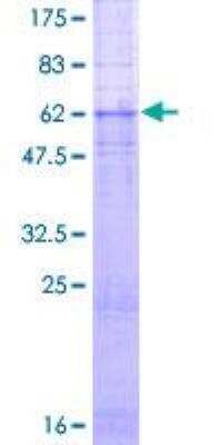 SDS-PAGE: Recombinant Human Gastrin-releasing Peptide R/GRPR GST (N-Term) Protein [H00002925-P01]