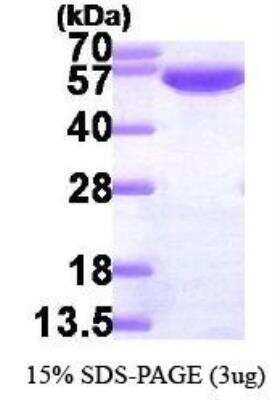 SDS-PAGE: Recombinant Human Glucose 6 phosphate isomerase His Protein [NBP3-07000]