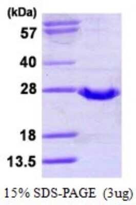 SDS-PAGE: Recombinant Human Glutathione Peroxidase 2/GPX2 His Protein [NBP1-78824]