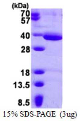 SDS-PAGE: Recombinant Human HAAO His Protein [NBP1-98968]