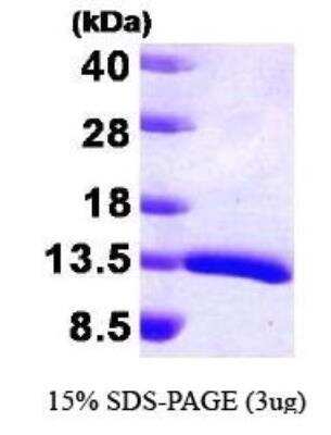 SDS-PAGE: Recombinant Human HDGF Protein [NBP1-30260]