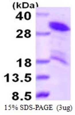 SDS-PAGE: Recombinant Human HDGFRP3 His Protein [NBP1-78865]
