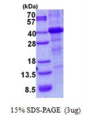 SDS-PAGE: Recombinant Human HFE His Protein [NBP2-23110]