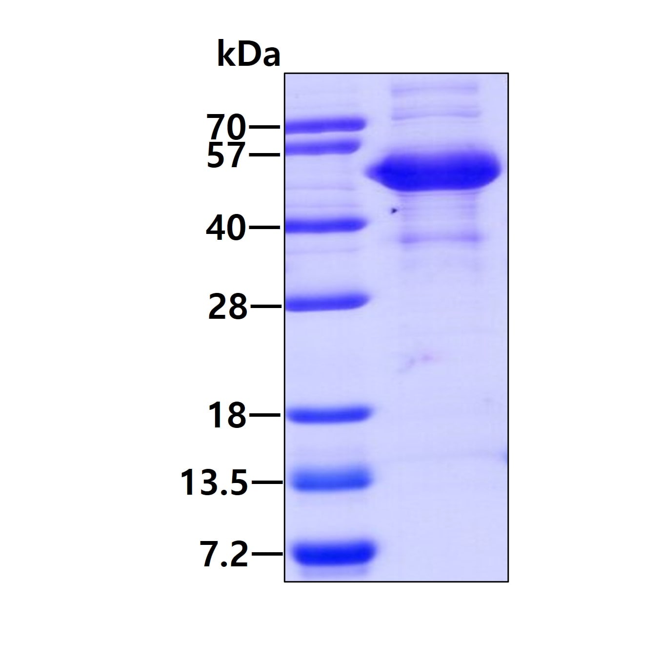 SDS-PAGE: Recombinant Human Hsp70 interacting protein HIP Protein [NBC1-19066]