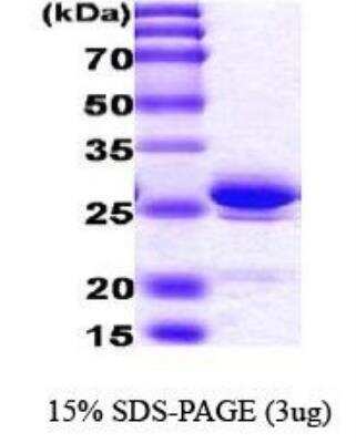 SDS-PAGE: Recombinant Human HMGB1/HMG-1 His Protein [NBC1-18488]