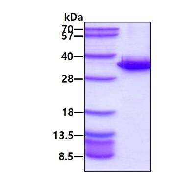 SDS-PAGE: Recombinant Human HMGB2 His Protein [NBP1-72386]