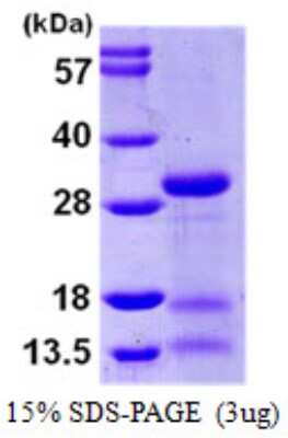 SDS-PAGE: Recombinant Human IDI2 His Protein [NBP1-51070]