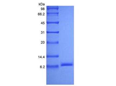 SDS-PAGE: Recombinant Human IGF-II/IGF2 Protein [NBP2-59722]