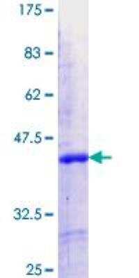 SDS-PAGE: Recombinant Human IKZF5 GST (N-Term) Protein [H00064376-Q01]