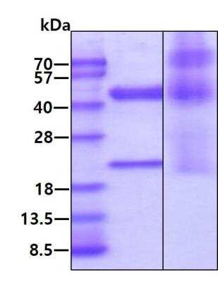 SDS-PAGE: Recombinant Human IL-23 His Protein [NBP2-80388]