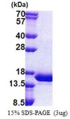SDS-PAGE: Recombinant Human INCA His Protein [NBP2-22737]