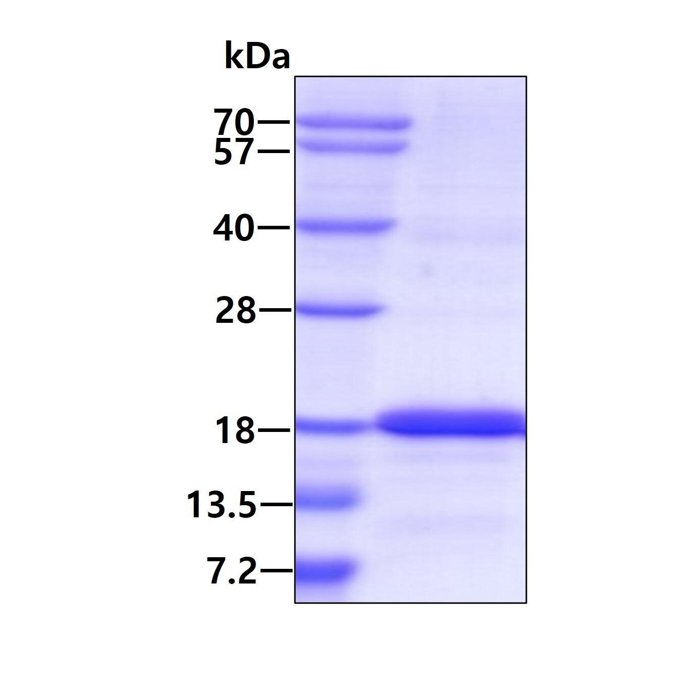 SDS-PAGE: Recombinant Human ISCU His Protein [NBP1-50926]