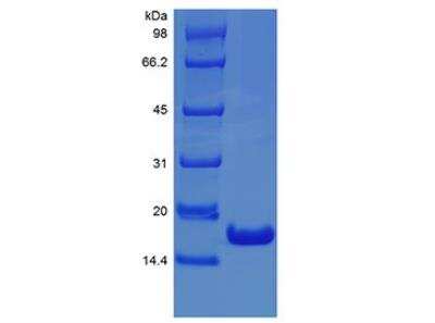 SDS-PAGE: Recombinant Human IFN-alpha 2 (alpha 2b) Protein [NBP2-34978]
