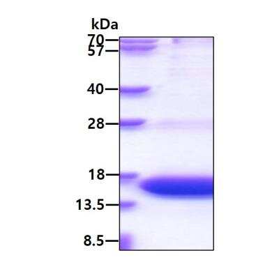 SDS-PAGE: Recombinant Human KIBRA His Protein [NBP2-51564]