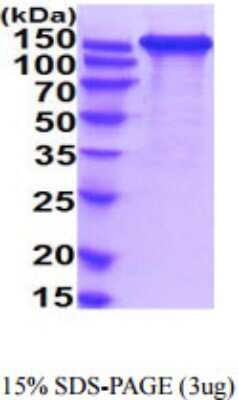 SDS-PAGE: Recombinant Human L1CAM His Protein [NBP2-59904]