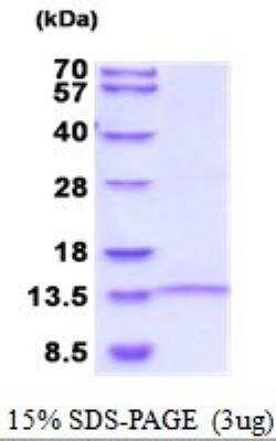 SDS-PAGE: Recombinant Human LINGO-1 His Protein [NBP2-52016]