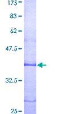 SDS-PAGE: Recombinant Human LPAR1/LPA1/EDG-2 GST (N-Term) Protein [H00001902-Q01]