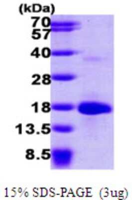 SDS-PAGE: Recombinant Human LSM4 His Protein [NBP1-50944]