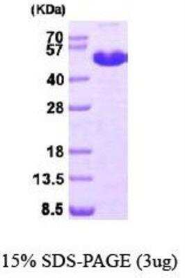 SDS-PAGE: Recombinant Human MAT1A His Protein [NBP1-40408]