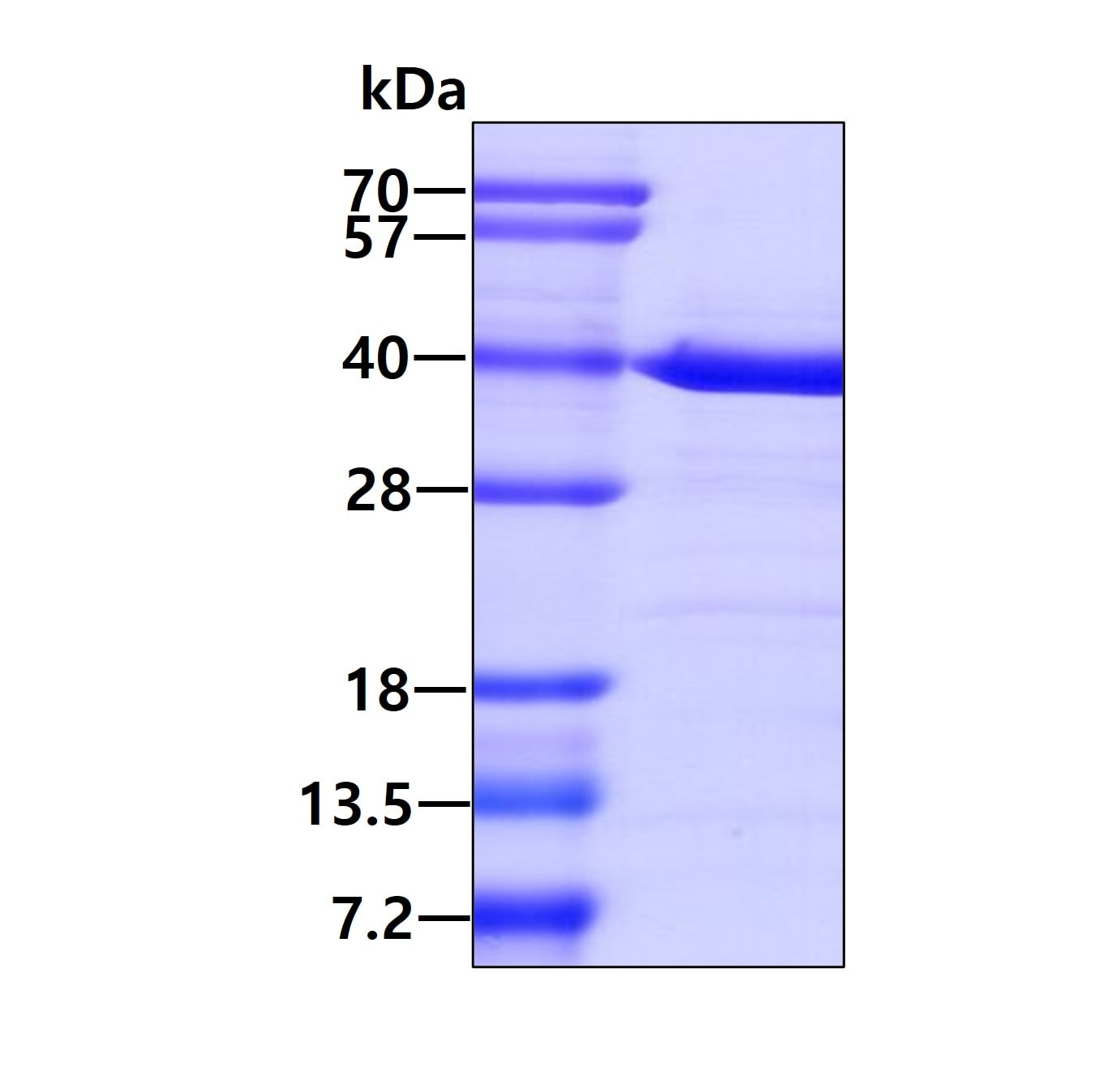 SDS-PAGE: Recombinant Human MAT2B Protein [NBP1-30288]