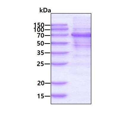 SDS-PAGE: Recombinant Human MAVS His Protein [NBP2-23238]