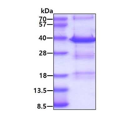 SDS-PAGE: Recombinant Human MED4 His Protein [NBP1-44479]