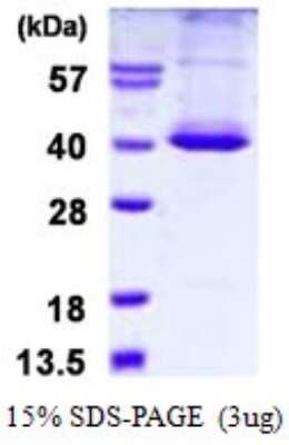 SDS-PAGE: Recombinant Human STK16 His Protein [NBP1-98961]