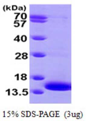 SDS-PAGE: Recombinant Human MP1/MAP2K1IP1 His Protein [NBP1-50889]