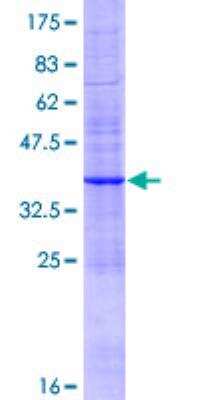 SDS-PAGE: Recombinant Human MRP6 GST (N-Term) Protein [H00000368-P01]