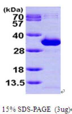 SDS-PAGE: Recombinant Human NANP His Protein [NBP1-49308]