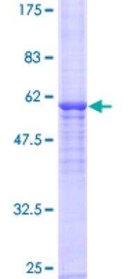 SDS-PAGE: Recombinant Human NAT2 GST (N-Term) Protein [H00000010-P01]