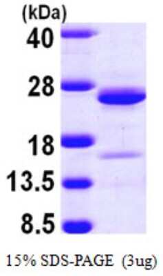 SDS-PAGE: Recombinant Human NCALD His Protein [NBP1-50975]