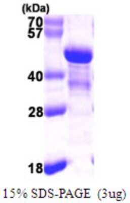 SDS-PAGE: Recombinant Human NDE1 His Protein [NBP1-51090]