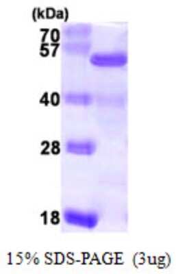 SDS-PAGE: Recombinant Human NELF-E His Protein [NBP1-51044]